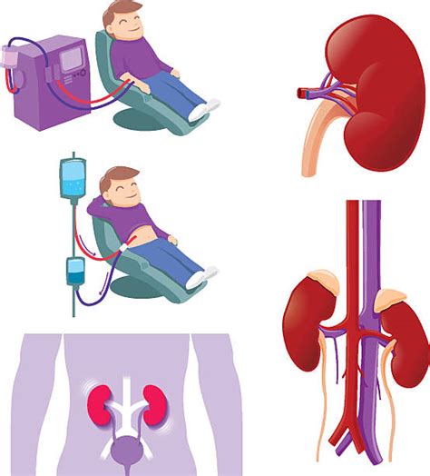 480 Dialysis Cartoons Stock Illustrations Royalty Free Vector