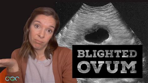 What is a blighted ovum?