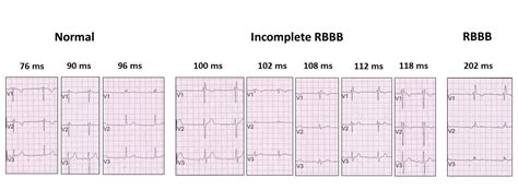 rSr’ in V1 - Resources