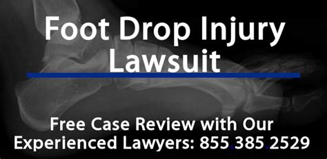 Foot Drop Nerve Damage Lawsuit – Medical Malpractice Attorney ...