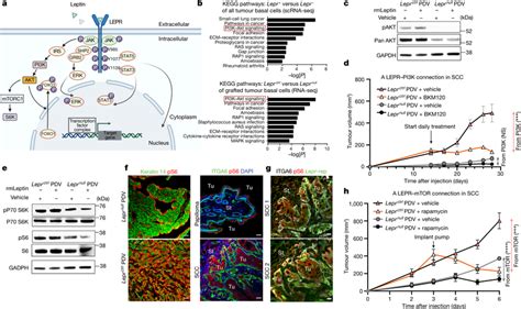 Leptin Receptor Signalling Promotes Scc Progression Through The