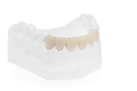 Puche Dental Lab Guards Implants Restoration Dentures