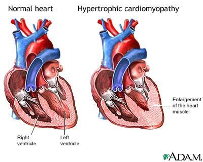 What do my cardiac ECHO results mean? | Cardiac Health