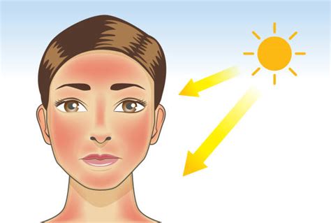 redness  symptoms  treatment