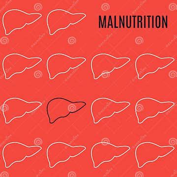 Malnutrition Liver Icon Patterned Poster in Linear Style Stock Vector ...