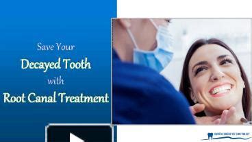 PPT Save Your Decayed Tooth With Root Canal Treatment PowerPoint