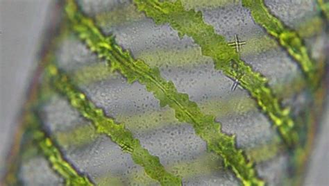 What is Spirogyra? (Characteristics, Classification, and Structure) – Microscope Clarity