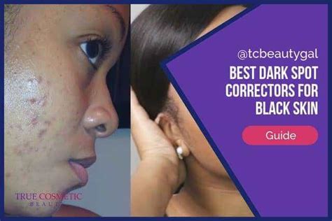 Best Dark Spot Corrector For African American Skin 2020 - Bios Pics