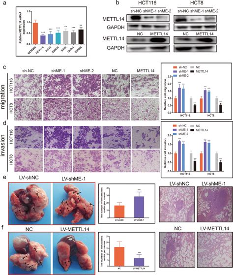 Mettl Inhibits Crc Cell Migration Invasion And Metastasis A The