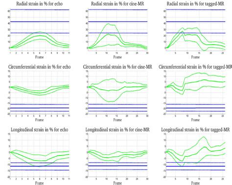 Strain Curves In The Radial Left Circumferential Middle And