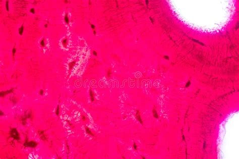 Histological Bone Elastic Cartilage Human And Joint Of Human Foetus Under The Microscope For