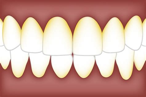 Plaque and Tartar Are a Problem, But Why? - Catonsville Dental Care