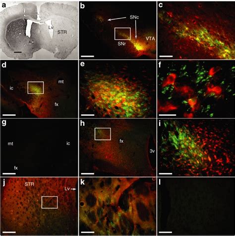 Gdnf Distribution And Viral Transduction Pattern A Sections From An