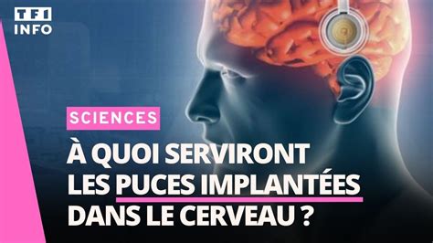 Puces implantées dans le cerveau quelles promesses YouTube