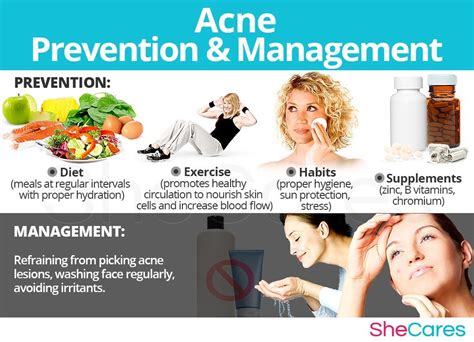 Acne Prevention And Management Prevent Acne Acne Proper Hygiene