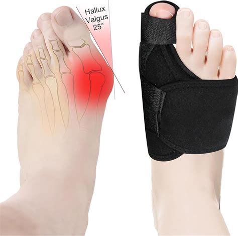 XIZAO Hallux Valgus Korrektur Schiene Zehenspreizer Universalgröße 2x