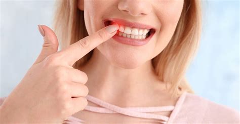 Understanding Gum Disease Prevention Symptoms And Treatments