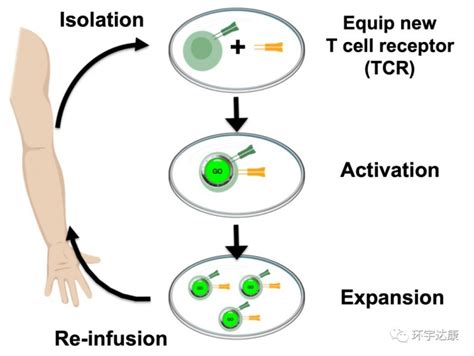 癌症肿瘤治疗新技术 T细胞疗法 过继性T细胞疗法 TCR T免疫治疗对多种晚期实体肿瘤有效 全球肿瘤医生网