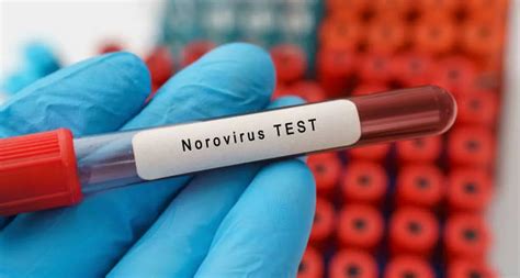 how long does it take to get the norovirus