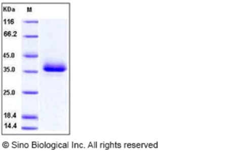 Sino Biological Human CD2 Protein ECD His Tag 100ug Quantity Each