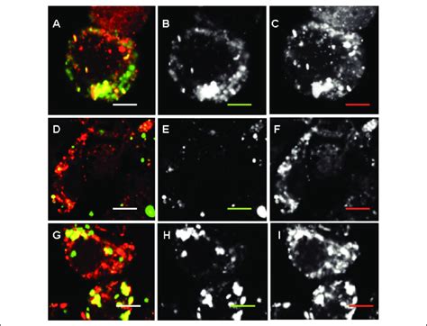 Colocalization Of Negatively Charged Nps With Lysosomes Raw2647 Cells