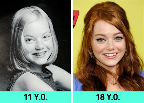 How Emma Stone Who Used To Be Just A Funny Girl From Teen Comedies