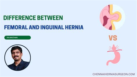 The Key Differences Of Femoral And Inguinal Hernias