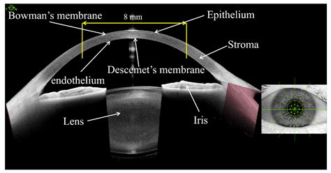 Diagnostics Free Full Text Comparison Of Mean Corneal Power Of