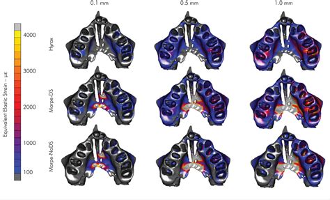 SciELO Brasil Biomechanical Behavior Of Three Maxillary Expanders