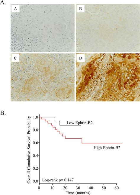 Immunohistological Examination Of Clinical Specimens From 50 Patients