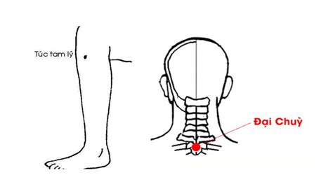 Cách Bấm Huyệt Chữa Bệnh Trĩ Hiệu Quả Cần Lưu ý Những Gì