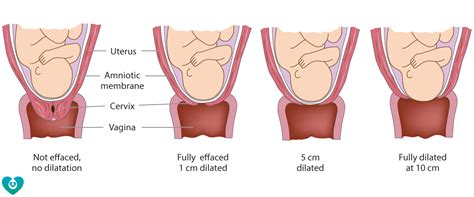 Stages Of Labor Diagram