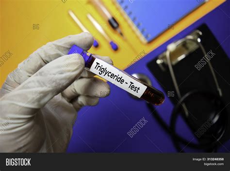 Triglyceride Test Image And Photo Free Trial Bigstock