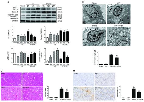 Ischemic Preconditioning Ipc Induces Autophagy And Has A Protective