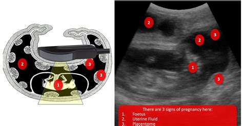 Ultrasound Scanning Ageing The Bovine Foetus Veterinary Practice