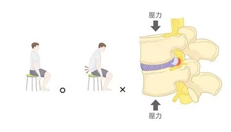 預防和恢復腰間盤突出從好的姿式開始 每日頭條