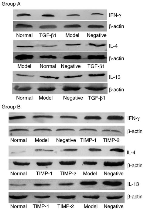 Expression levels of IFN γ IL 4 and IL 13 detected by western