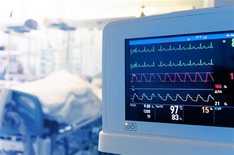 How Serious Is Cardiac Arrhythmia? - CVRTI