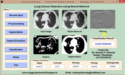 Lung Cancer Detection Using Neural Network Matlab Project Source Code