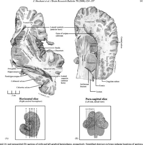 Figure 12 from Elephant brain: Part I: Gross morphology, functions, comparative anatomy, and ...