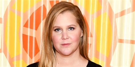 Amy Schumer Opens Up About Her Hair Pulling Disorder