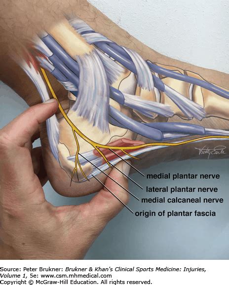 Medial Plantar Nerve Pain Hot Sex Picture