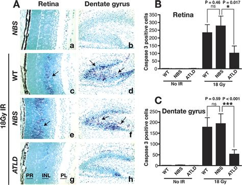 Differential DNA Damage Signaling Accounts For Distinct Neural