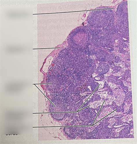 Structure Of Lymph Node Diagram Quizlet