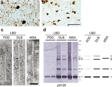 Ultrastructural And Biochemical Characterization Of Pathogenic α Syn