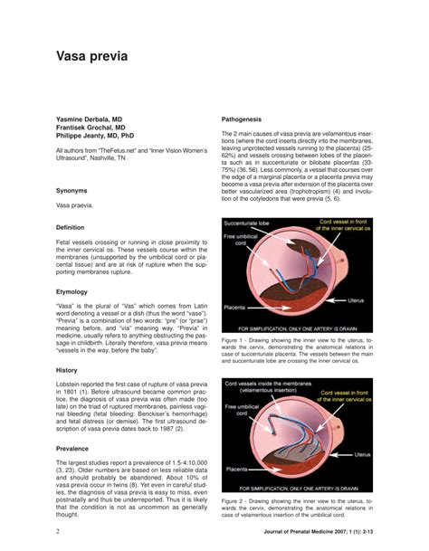 (PDF) Vasa previa