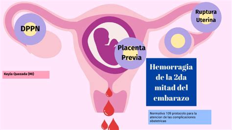 Introducir 57 Imagen Hemorragias De La Segunda Mitad Del Embarazo