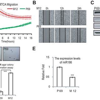 In Vitro Angiogenesis Assay Of Msc Conditioned Media A Schematic