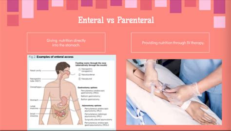 Clinical Skills Enteral Feeding Flashcards Quizlet