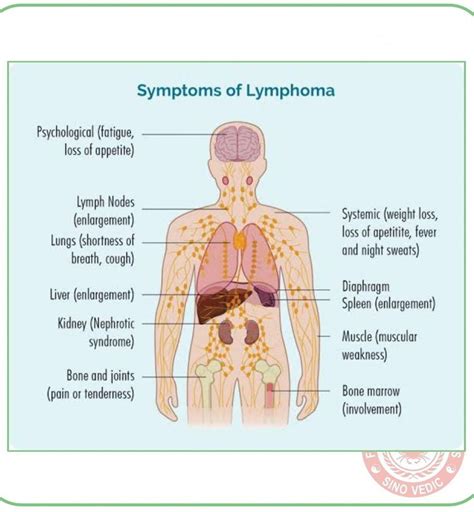 10 foods to boost the lymphatic system for improved health infographic ...